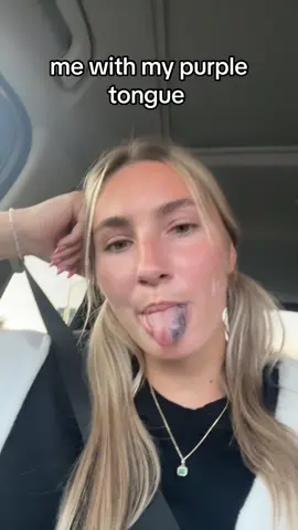 feeling extra unique with this trend 