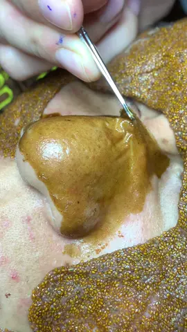 Lên phê thật #chamsocdamun#chamsocdaseo#chamsocdanam#tanbinh#Lqspa&academy