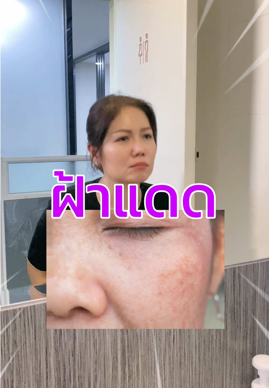 ฝ้าแดด ฝ้าฮอร์โมน ผิวหมองหลบไป ✨ถึงเวลาลองนวัตกรรมใหม่! . อะลิเซ่ครีมทาฝ้า มาพร้อมสารสกัด Melatien X เข้มข้นกว่าอาร์บูตินถึง 80 เท่า ครีมเนื้อเซรั่ม บางเบา ป้องกันฝ้าใหม่ ยับยั้งฝ้าเก่า บำรุงผิวกระจ่างใสได้ใน 7 วัน . #ALESE #อะลิเซ่ครีมทาฝ้า #ครีมฝ้า #ครีมซองเซเว่น 