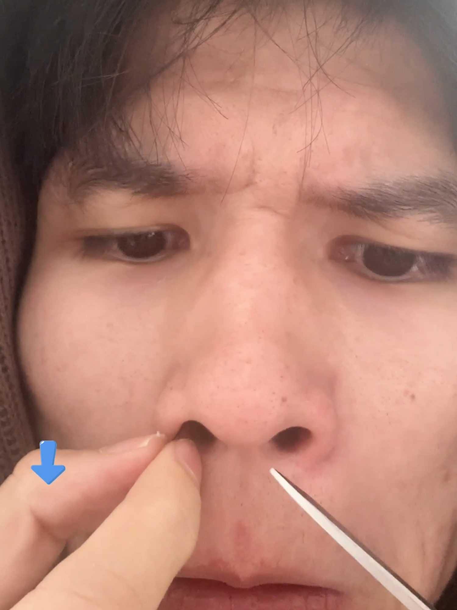 Rak perlu cabut , potong ja oakai machine ni lagi senang n tak sakit#pencukurbuluhidung