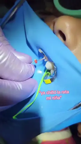 😵‍💫Qué satisfacción! 🦷 #odontopediatría #fyp  #odontologia 