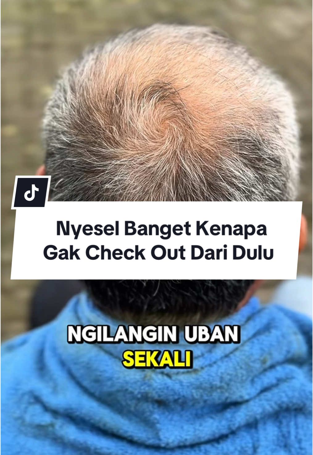 💕 SHAMPOO UBAN VIRAL SACHET 💕 Shampoo uban ampuh banget, sekali keramas uban terhempas Ada 4 pilihan warna Hitam, Coklat, Coklat Tua & Biru Tua Hadir dengan 4 kemasan (Botol, Sisir,  Sachet & New Look) Langsung aja klik keranjang kuning atau join live sekarang😍 ✨ #PromoGuncang111 #shampoouban #myiwe #haircoloring #fyp