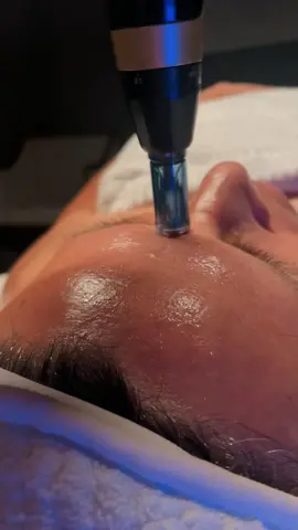 ENZYME • PDRN • FIRMING Level III: SKN Pro  LuxeLift Facial + PDRN Nano-Needling Enzymes used to breakdown dead skin cells Nano-Needling PDRN to repair skin, produce collagen & elastin layered UNDER the  Firming Mask to lock in PDRN benefits while, firming, tightening, and oxygenating the skin  Layering these different modalities in a custom protocol to bring you luxury results driven corrective facials After this facial my client said “I feel like I look younger”  Honestly, the best compliment as I specialize in Anti-Aging treatments, with consistency and patience we can accomplish your skin goals ✨ #antiagingskincare #laredotx #facialtreatment #antiaging 