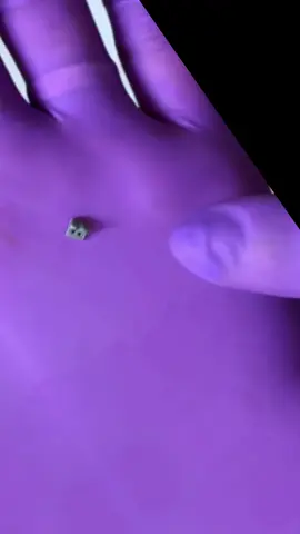 Gestire la rotazione dentale non è mai stato così semplice. I cunei di rotazione (Rotator) sono un piccolo ausilio, ma fondamentali per ottenere movimenti più controllati e prevedibili nei denti girovertiti. 👉 Perché utilizzarli? • Applicano una forza mirata sulla superficie del dente • Favoriscono una rotazione efficace verso linguale/palatale • Si inseriscono facilmente grazie ai due fori di ancoraggio sul bracket • Il filo passa sopra il loro elastico, creando la spinta rotazionale desiderata • Stabilizzazione finale tramite legatura (amarrilho) Questi dettagli tecnici possono fare la differenza nel risultato clinico. 🔧 Vuoi integrarli nella tua pratica? Li trovi su Orthoteam, il tuo fornitore specializzato per tutto ciò che riguarda l’ortodonzia. 🌐 www.orthoteam.it 📞 347 2947397 Orthoteam — Materiali selezionati con la stessa precisione con cui lavorate ogni giorno.