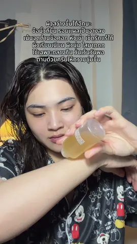 #เซรั่มอันเทียร่า #antheara #เซรั่มผลัดเซลล์ผิว #peelingserum #รีวิวบิ้วตี้ 