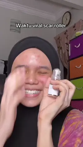 Sumpah selalu pakai mmg glowing je muka, tp ckupla 2 x buat . Taktahan den #scarroller 