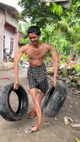 This young boy had lived with a very rare birth defect since birth, preventing him from living a normal life.#foryou #america #fypシ゚viral #fypシ゚viral🖤tiktok #foryourpage