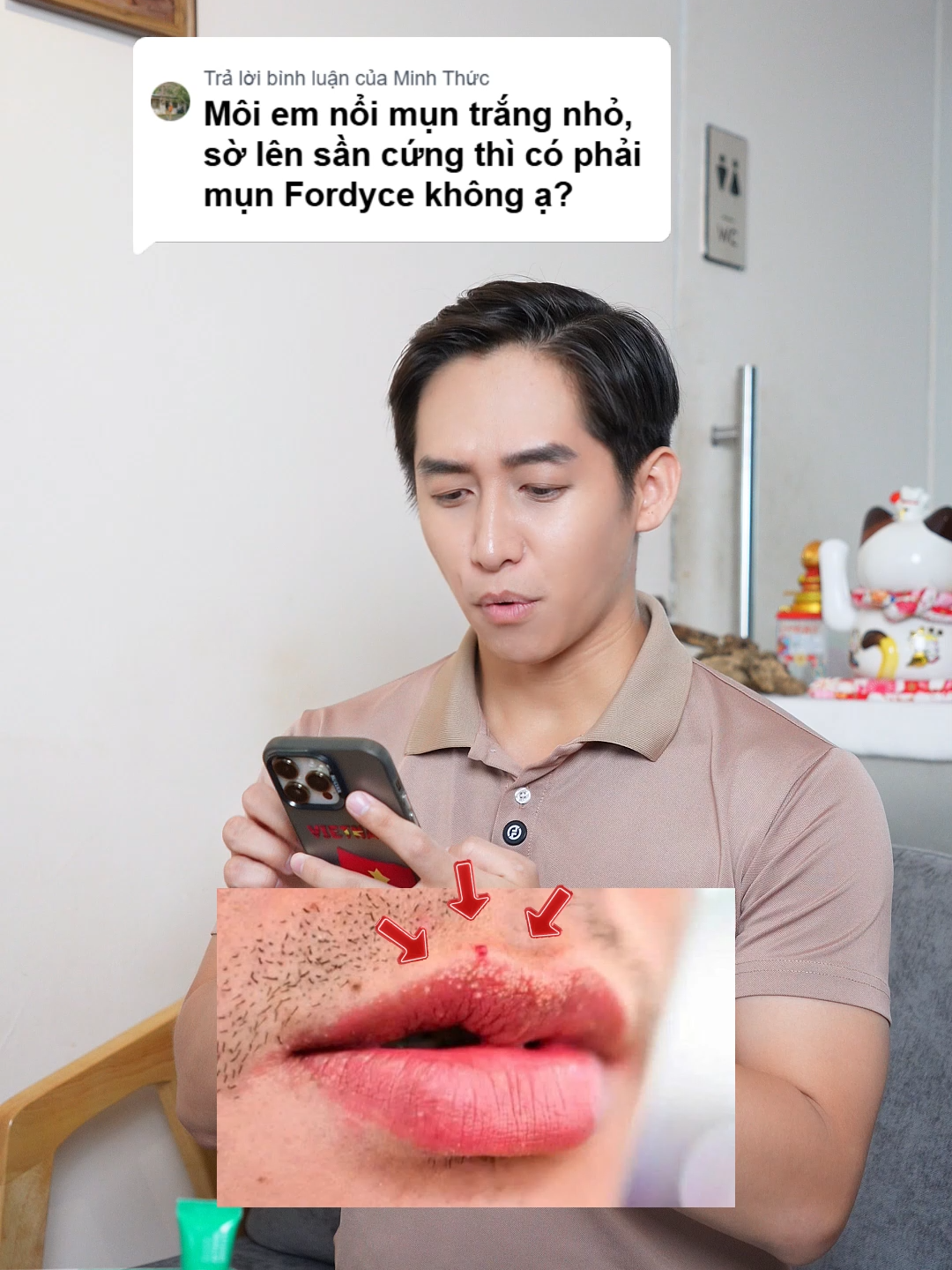 Môi em nổi hạt trắng nhỏ, sờ lên sần cứng có phải mụn fordyce không? #abera #aberafordyce #fordyce