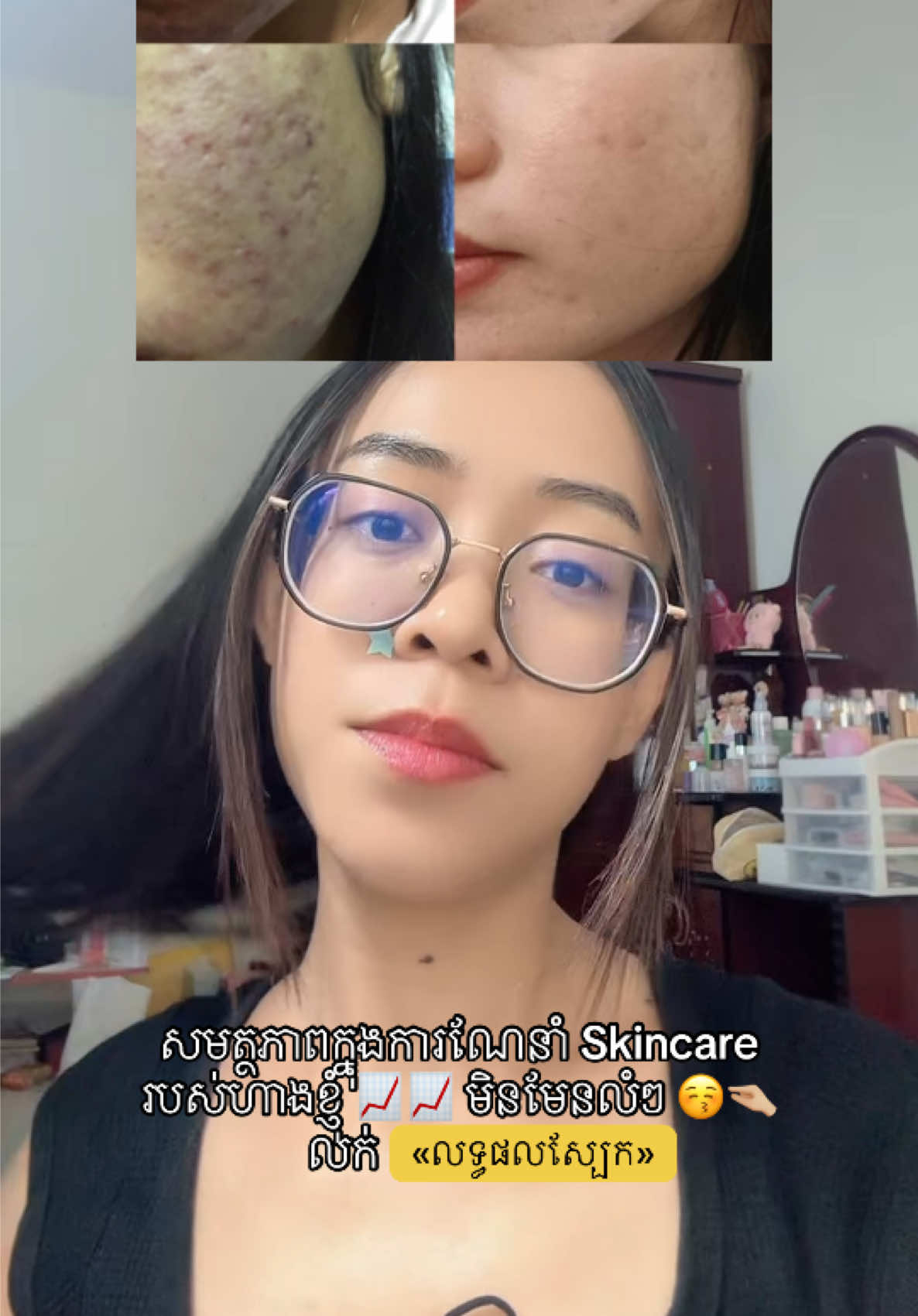 Skincare Routine ចេញពីខាងខ្ញុំទៅ គឺដើម្បីដោះស្រាយបញ្ហា 😁 Case ស្រាល Case ធ្ងន់ Case មុន Case ជាំអីជួបអស់ហើយ 🥹 ខ្ញុំប្រណាំងយកគុណតម្លៃស្នូលគឺលទ្ធផលស្បែករបស់ភ្ញៀវ អត់ប្រណាំងយកតម្លៃថោកជាងគេ តែលទ្ធផលមិនដឹងជាស្អីទៅជាស្អីទេ ! WITH NICHHY SKIN, YOU PAY FOR YOUR SKIN RESULT ✨✨ 