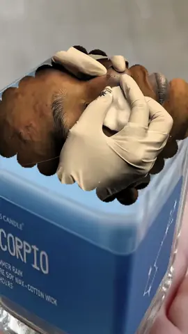 #acne #acnetreatment #acneproneskin #ConSantanderConecto 