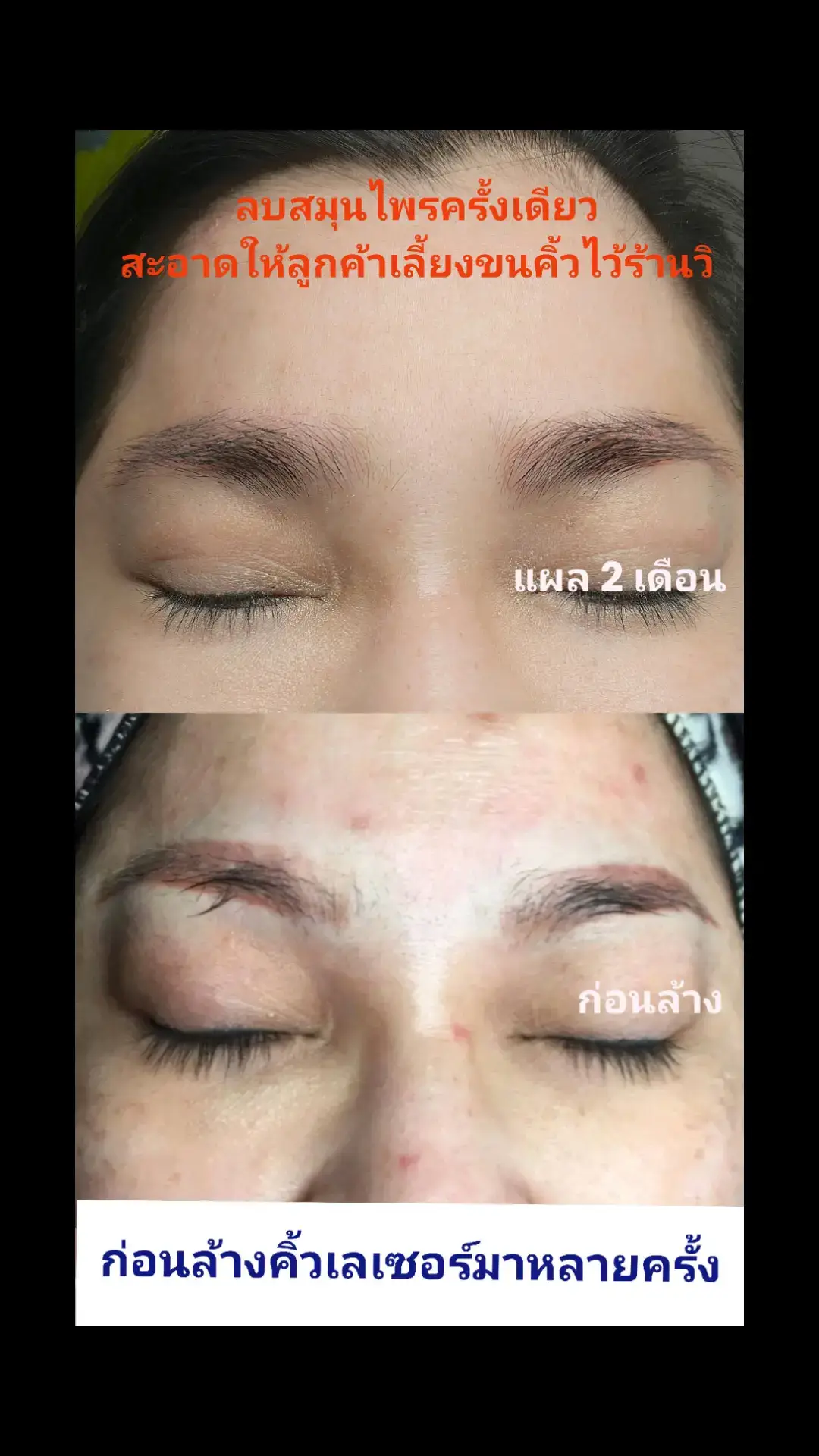 #สักปากเสริมโหงวเฮ้งอาจารย์วิสมุทรสาคร #สักคิ้วสไลด์สีฝุ่นอาจารย์วิสมุทรสาคร #ลบสีสกินหรือสีขาวอาจารย์วิสมุทรสาคร #ลบคิ้วล้างคิ้วแก้คิ้วอาจารย์วิสมุทรสาคร #ลบรอยสักช่างเอสมุทรสาคร 