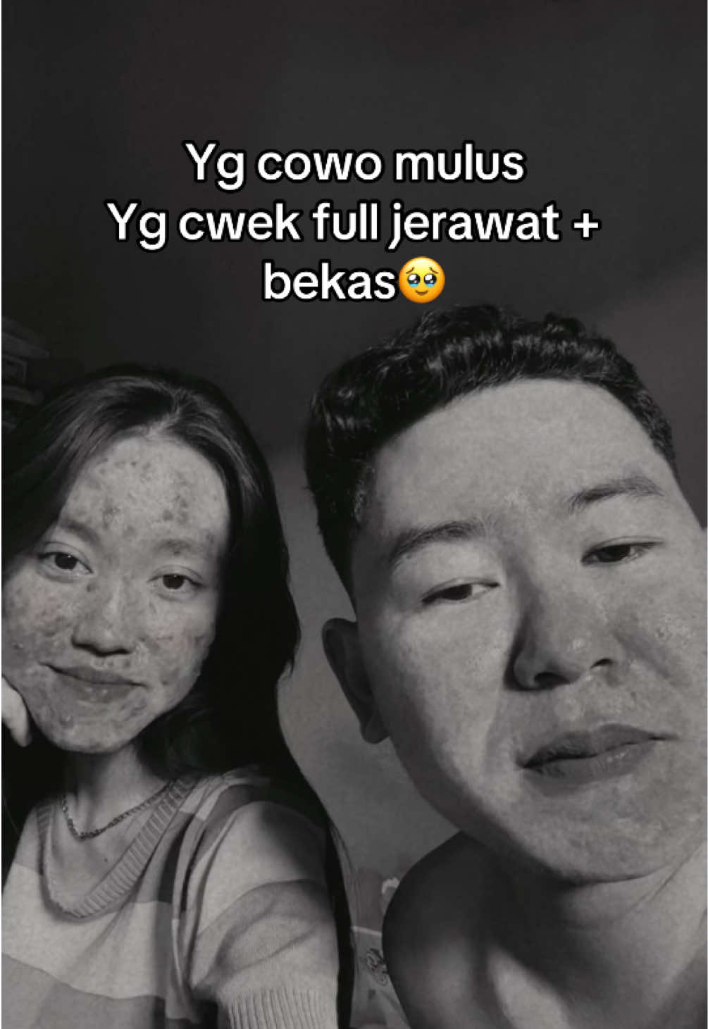 Draft minggu lalu 🥹 #fyp #acne #acnefighter #acneskin #xyzbcafypシ 