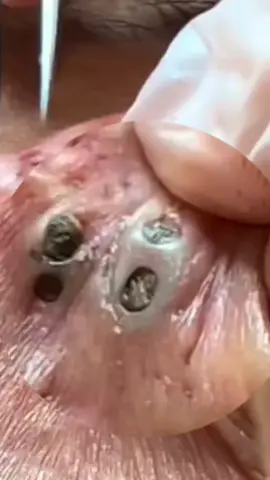 #cravoseespinhas #relaxante #foryou #cravossatisfatorios #fy