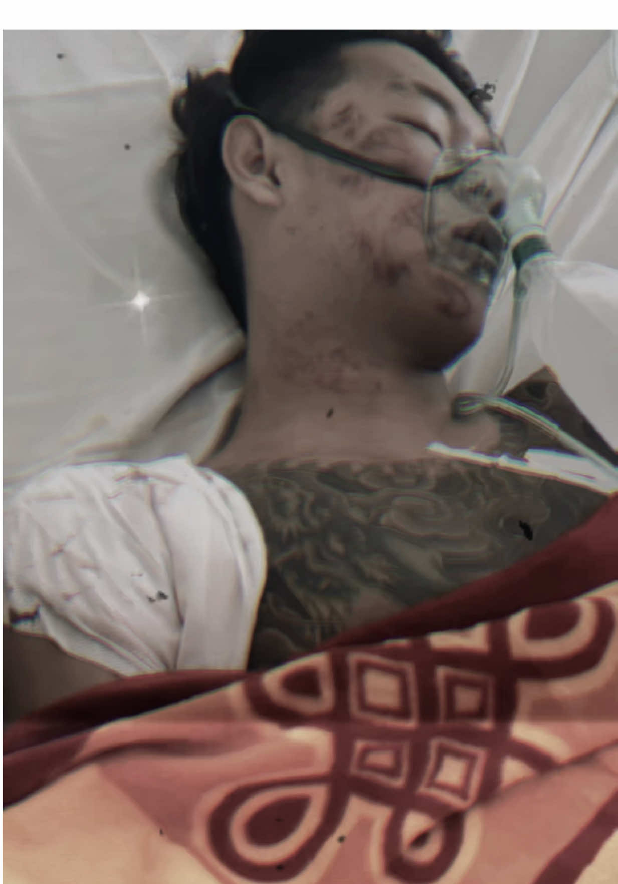 Nó cầm hàng xa anh đỡ mà bệnh viện đỡ anh 😂#xuhuongtiktok 