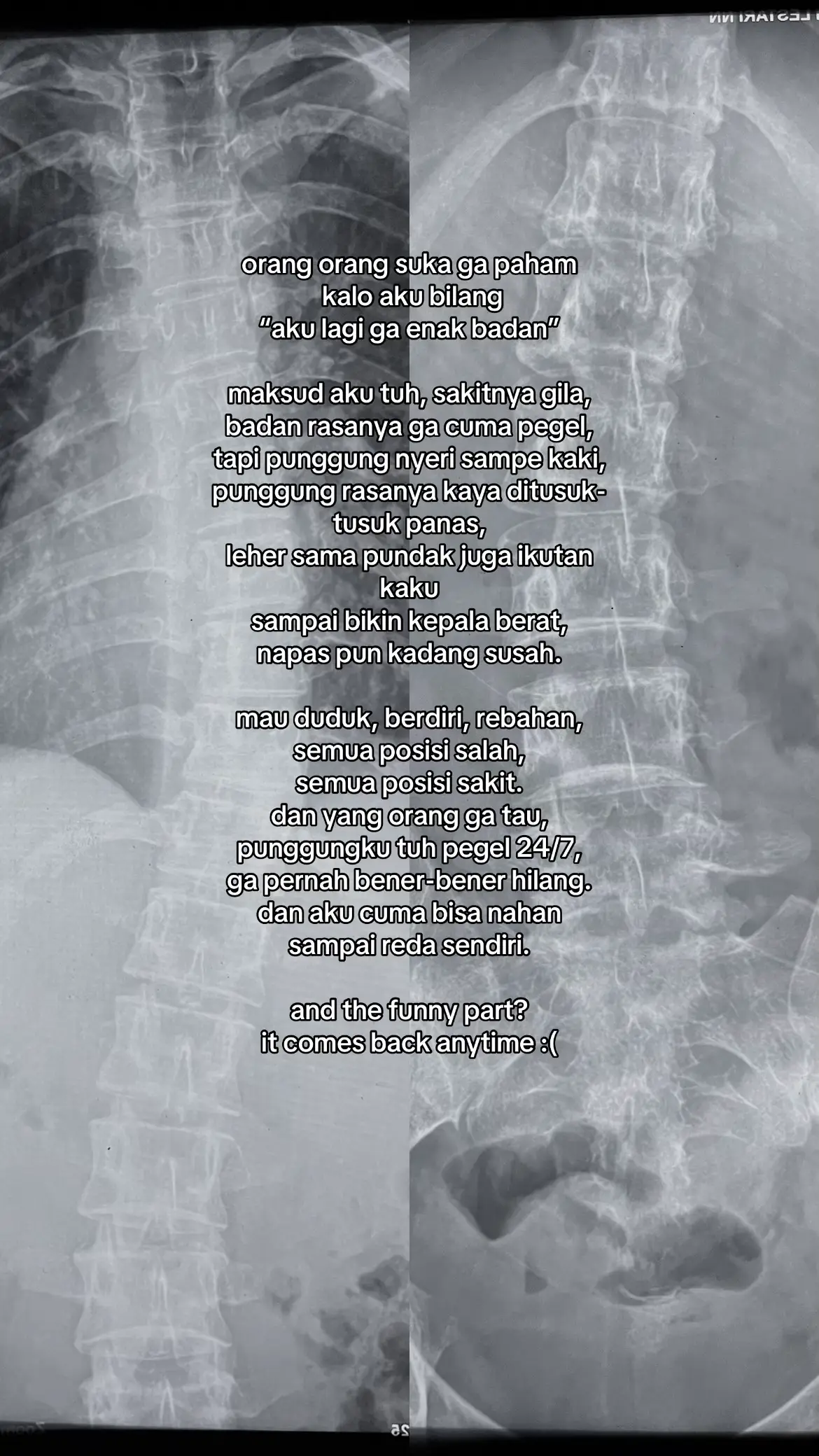 but it’s okay, with stretching, hanging, and swimming, I’ll be okay :) #scoliosis #scoliosisfighter #foryou #galaubrutal 