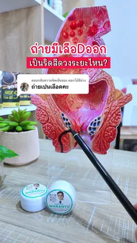ถ่ายมีเลือดออก เป็นริดสีดวงระยะไหน? #doctorwaranyu #หมอวรัญญู #ครีมทาริดสีดวง #ริดสีดวง 