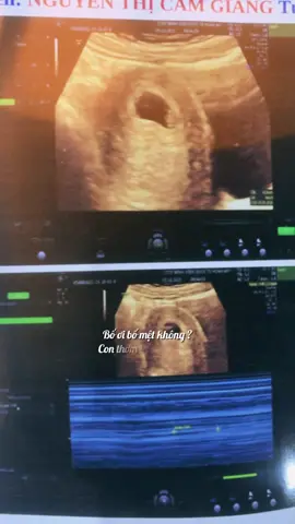 Động lực để bố cố gắng mỗi ngày. E bé ngựa🦄 29-5-2026 bám chặt mẹ đủ ngày đủ tháng rồi ra gặp bố mẹ con nhé #CapCut #embedangyeu #embedethuong #embengua2026 #tiktok 