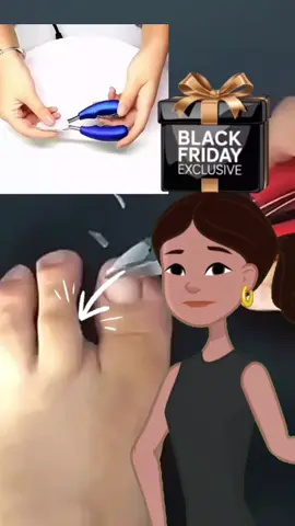 Kit 3 alicates de unha #tiktokshopblackfridaybr #alicate #alicatedeunha #tiktokshop #promocao 