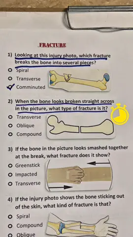 Fracture and its Types. Don’t scroll answer the last one. #medical #medicalstudents #nurse #quiz #unfreezemyacount 
