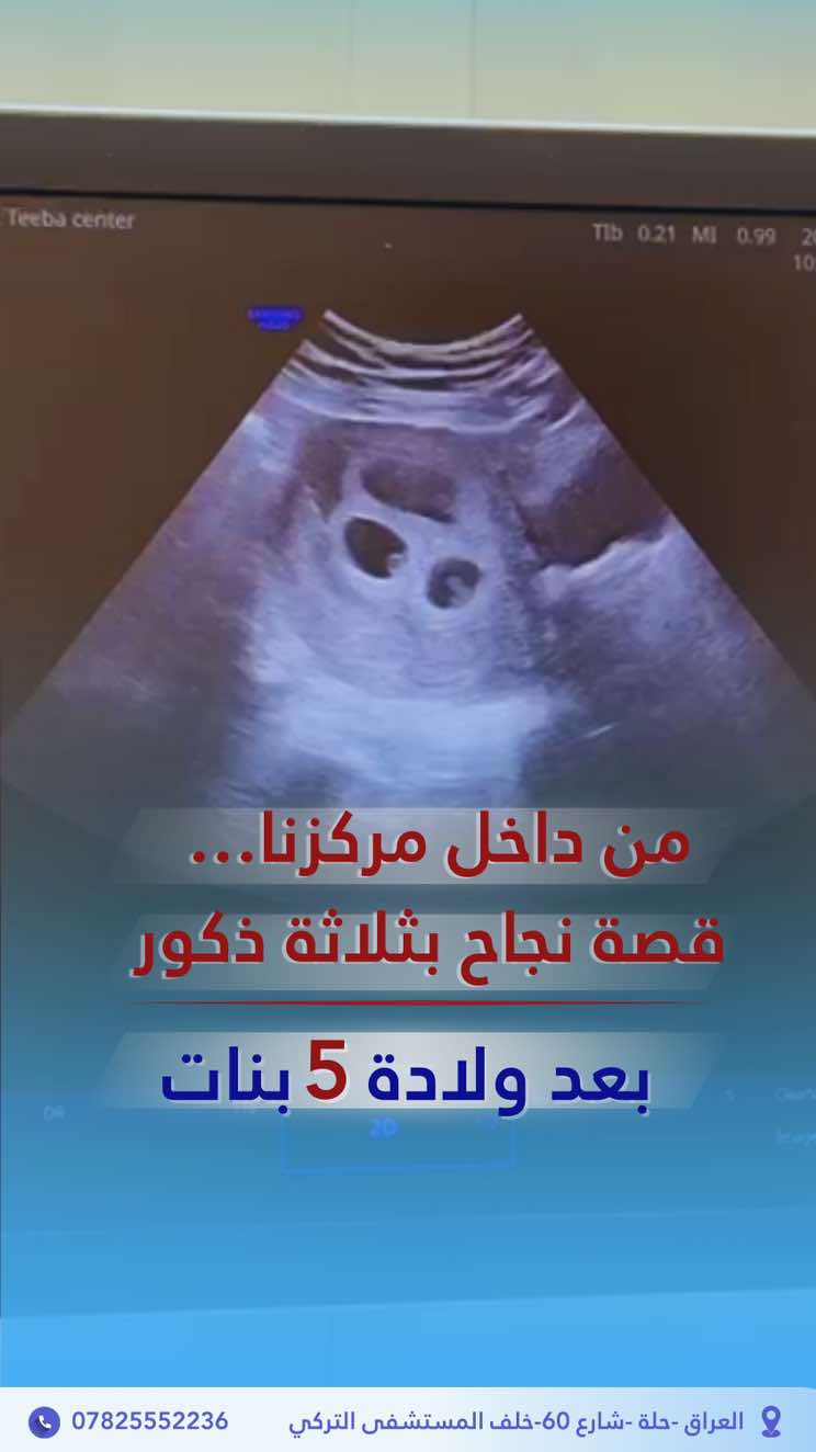 العنوان :  العراق  - الحله - شارع 60 - خلف المستشفى التركي . بإشراف الدكتور عدنان البديري للاستفسار  009647825552236 #مشاهدات_تيك_توك #اكسبلوررررررر #مركز_طيبة_التخصصي #fyp 