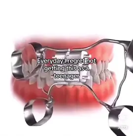 Guess we hardmax now #surgery #mog #bp 