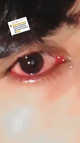 Replying to @👑☆𝓵𝓸𝓿𝓮𝓵𝔂𝓺𝓾𝓮𝓮𝓷☆👑 Meri Ankho ko Dakh kr #sadness #sadstory #😭😭😭 #foryou #foryoupage #unfreezemyacount 