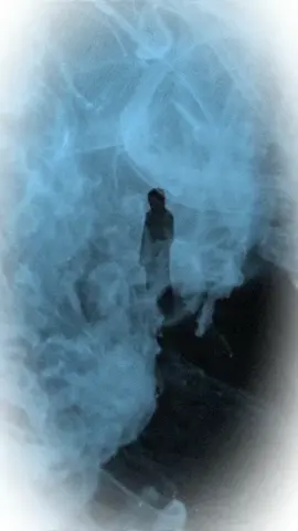 شتفيد الصور 💔🥺 #حزن💔💤ء  #viral #foryou #fypシ゚ #fyp 