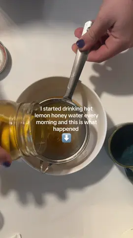 Drinking warm fermented lemon honey water every morning on and EMPTY STOMACH ⬇️⬇️ 🍋 less bloating! The acidity in the lemons helps support your stomach acid aiding in digestion and soothes the gut, while warm water stimulates bowel movements 🍋 stronger immune system Anytime I’ve started to feel sick it goes away so much faster! Honey is antimicrobial and a antioxidant helping keep your immune system strong! Psssst Using local honey helps fight against seasonal allergies! Vitamin c increases white blood cell activity, supports the skin barrier, and reduces inflammation acting as a strong antioxidant. 🍋 clearer skin! My acne has never been terrible but it definitely flares up every now and then and I’ve had far less since doing this! Lemon provides vitamin c which supports collagen production and reduces inflammation. Drinking a glass of water every morning helps you rehydrate after being dehydrated all night which in turn allows you to produce less sebum and flush out waste products more effectively! Who wants to know how to make it?!  #LemonHoneyWater #MorningWellness #NaturalImmunity #HolisticHealth #HealthyHabits