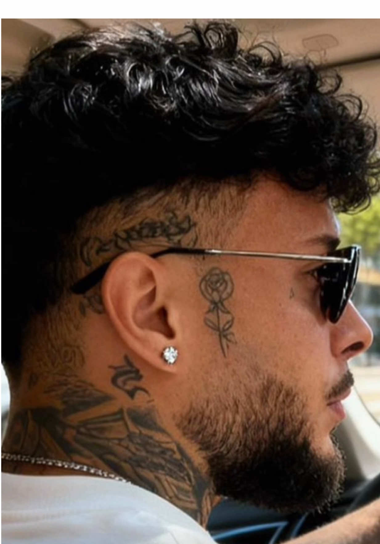 Dopo 1 anno dal trapianto di capelli, Kevin ci ha inviato queste foto 🤩 Da KEIT, ogni procedura viene eseguita secondo i più alti standard medici e con la massima cura per il paziente. 💜 Perché scegliere KEIT? Tecnica FUE – minimamente invasiva, massima precisione Nessun segno visibile Recupero rapido Risultati naturali e duraturi Team medico specializzato con anni di esperienza Qualità italiana, nel cuore di Tirana. KEIT, accarezziamo i tuoi sogni! 💜 Prenota una consulenza GRATUITA👇🏻  +390697639203 💜 #clinicakeit #keitclinic #accarezziamoisogni #chirurghiaestetica #chirurghiitaliani  