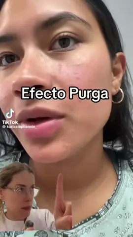 Incorporaste un producto nuevo de skincare y tu piel empezó a verse así? Mucho cuidado ‼️ podrías estar dañando tu piel 😨 . . . #drapascali #retinol #niacinamida #efectopurga #skincarebarrier  