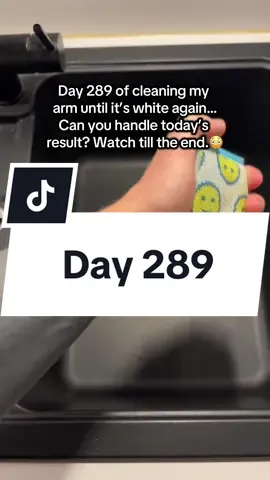 Day 289 of cleaning my arm…#day1 #day501 #cleaning 