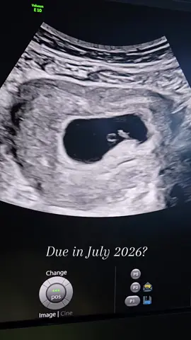 This is what your baby looks like right now if you're due around the 4th of July 🤩🇺🇲