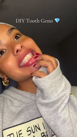 they actually fell off #toothgems #diygems #paratii #fyp 