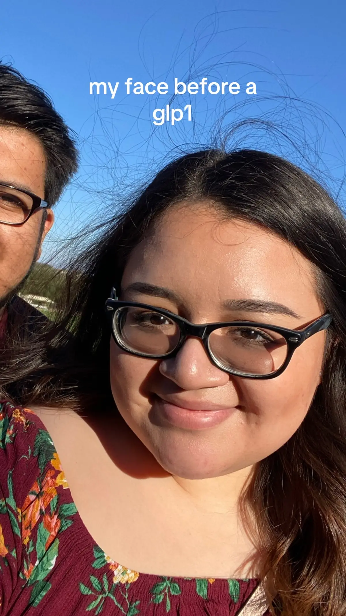 all this with a little help from @elara 🤍#beforeandafter #facetransformation #glp1community 