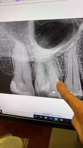 So much anatomy! #dentists #dentalstudent #rootcanal #dentalhygienist #dentalofficelife 