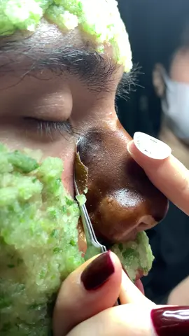 Phê chưa #chamsocdamun#chamsocdaseo#chamsocdanam#tanbinh#Lqspa&academy