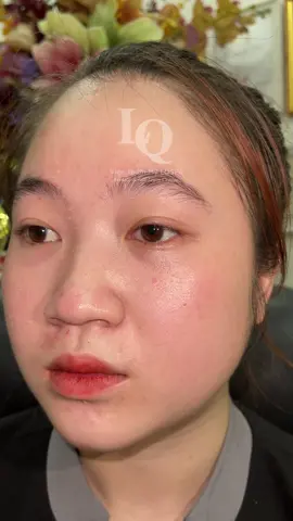 Tại nhà #chamsocdamun#chamsocdaseo#chamsocdanam#tanbinh#Lqspa&academy