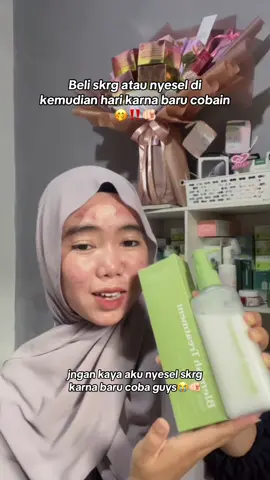ini baguss bgt, gak semua org tau lohhh😭🫵🏻@Noera By Reisha @Reisha Novandita  #noerabyreisha #noerabeautycare #blemishbodyserum 