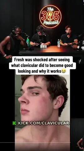 Fresh was shocked after seeing what clavicular did to become good looking and why it works😭 #clavicular #looksmaxing 