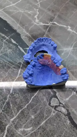 Gigi Tiruan valplast #gigipalsu #gigi #valplast #tangerang 