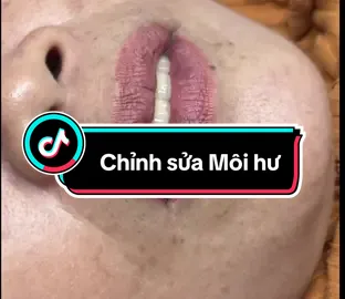 Sửa môi hư hơn nặng #chinhsuamoi#plasmamoi#phunmoi #phunxamthammy #xuhuongtiktok 