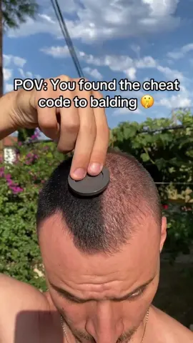 Don’t be like this guy  #TikTokShopBlackFriday #hairloss #dht #dhtblocker #hairgrowth 