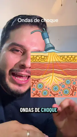 Acuérdense que esos resúmenes son cortos, pero los hago con la intención de qué entiendan las generalidades. Noseee necesita mucha ciencia para aplicar las ondas de choque, simplemente las bases de fisiología del cuerpo, los mecanismos de acción de las zonas de choque y listo #Terapia #Fisioterapia #health  #creatorsearchinsights 