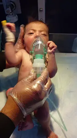 Nebulizer for Chest Congestion | Easy Breathing Care #cute #viral #criticalcare #hospitallife #nicu 