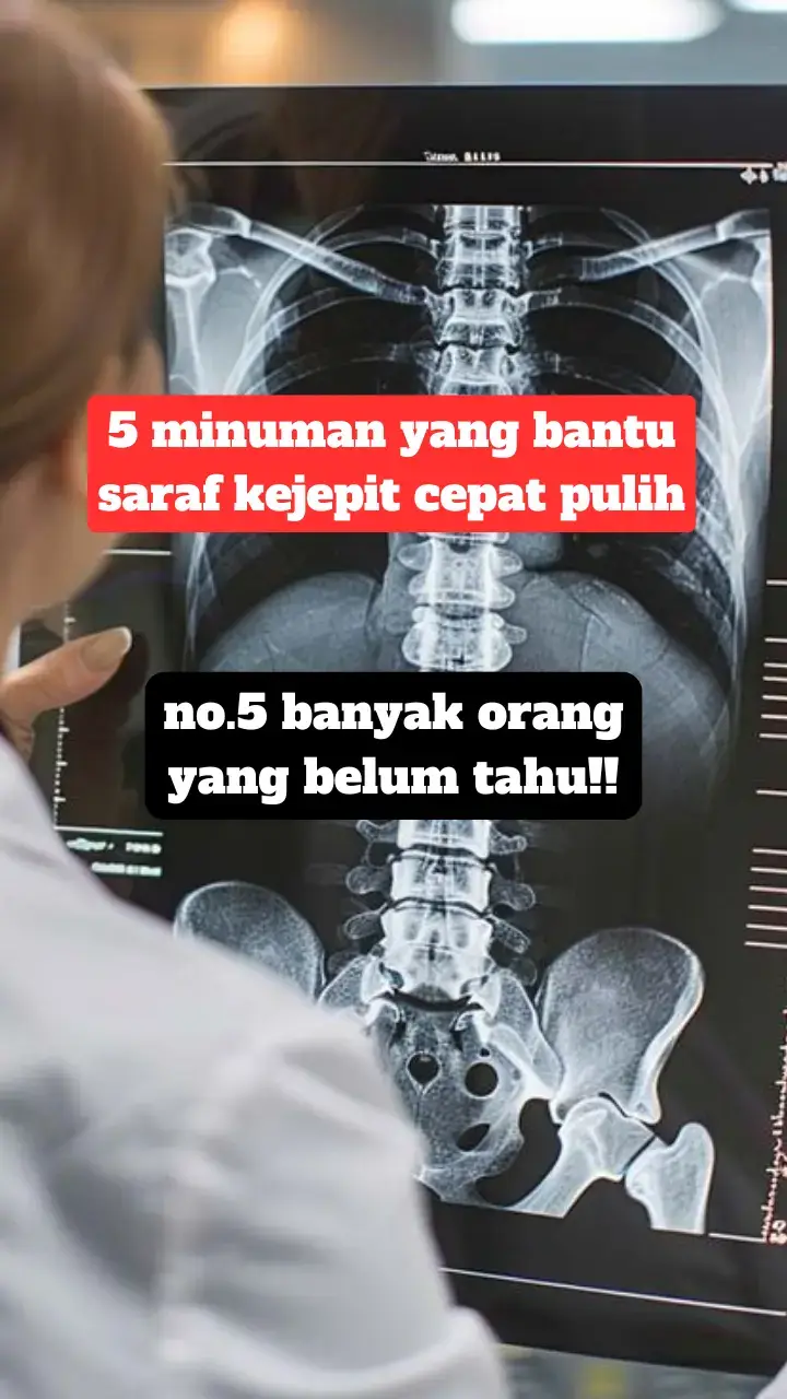 Buat kamu yang sering nyeri menjalar dari pinggang ke kaki, kesemutan, bahkan sulit jalan itu tanda saraf sedang terjepit dan butuh perbaikan dari dalam tubuh. Nah, selain menjaga postur dan istirahat cukup. berikut 5 minuman alami yang bantu regenerasi saraf lebih cepat: 1 Air Putih Hangat Menjaga hidrasi dan bantu lancarkan aliran darah ke saraf yang tertekan. 2 Air Jahe Hangat Mengandung antiinflamasi alami, bantu kurangi nyeri dan peradangan di area saraf kejepit. 3 Susu Tinggi Kalsium Membantu perbaiki tulang dan bantalan sendi agar tidak makin menekan saraf. 4 Jus Alpukat Kaya magnesium, lemak baik, dan vitamin B yang penting untuk regenerasi sel saraf. 5 Nutrisi Fitofarmaka Inilah pelengkap terbaik! Mengandung kombinasi bahan aktif herbal yang terbukti bantu memperbaiki sel saraf, kurangi nyeri, dan pulihkan fungsi tubuh tanpa operasi. Banyak yang sudah merasakan hasilnya setelah rutin konsumsi Fitofarmaka + pola hidup sehat. Rawat sarafmu dari dalam, jangan tunggu sampai lumpuh baru menyesal. Kalau kamu mau aku bantu rekomendasikan jenis Fitofarmaka yang sesuai kondisimu, komen 