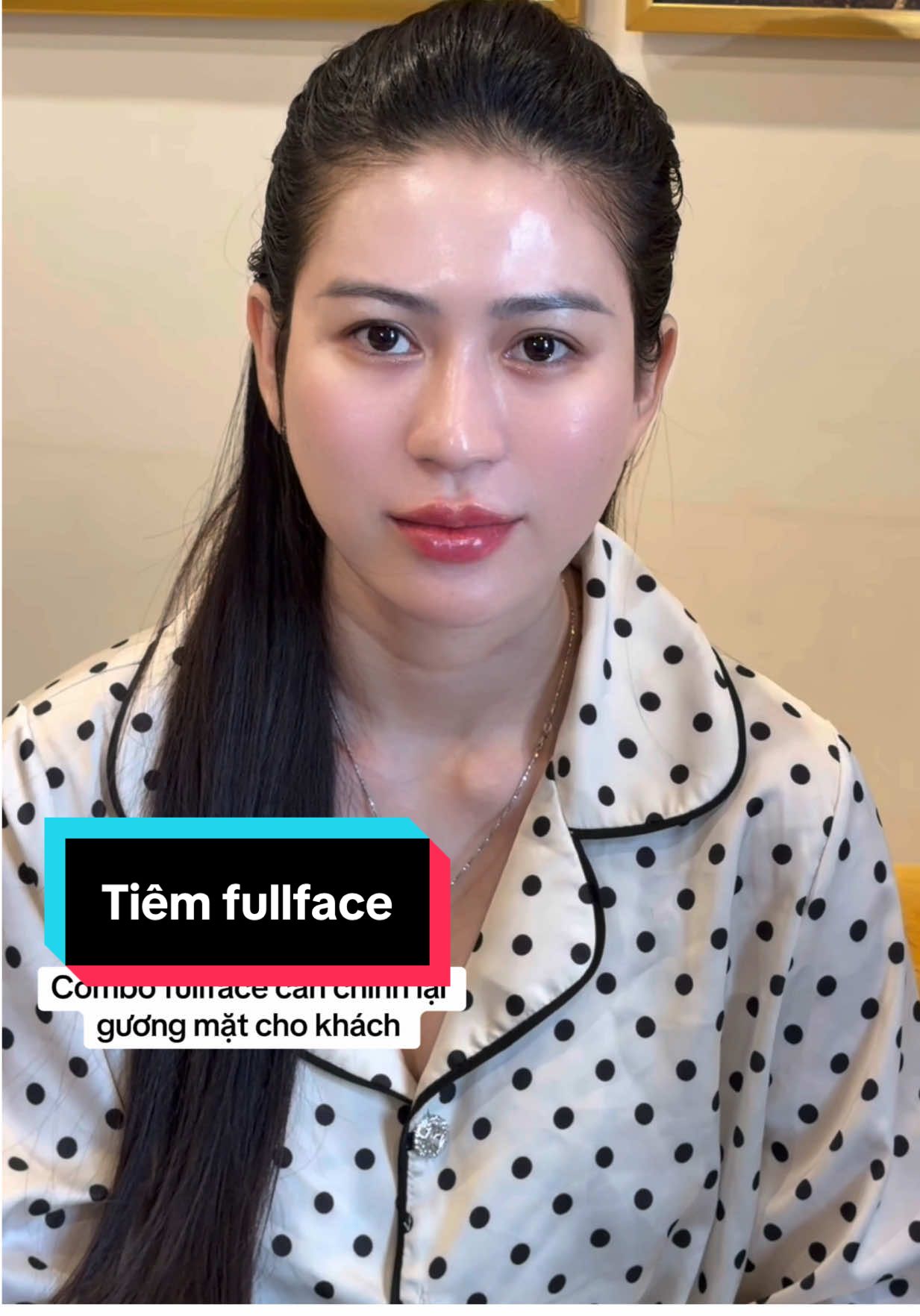 Tiêm chỉnh fullface cho khách yêu 💉#xuhuongthammy #xuhuong 