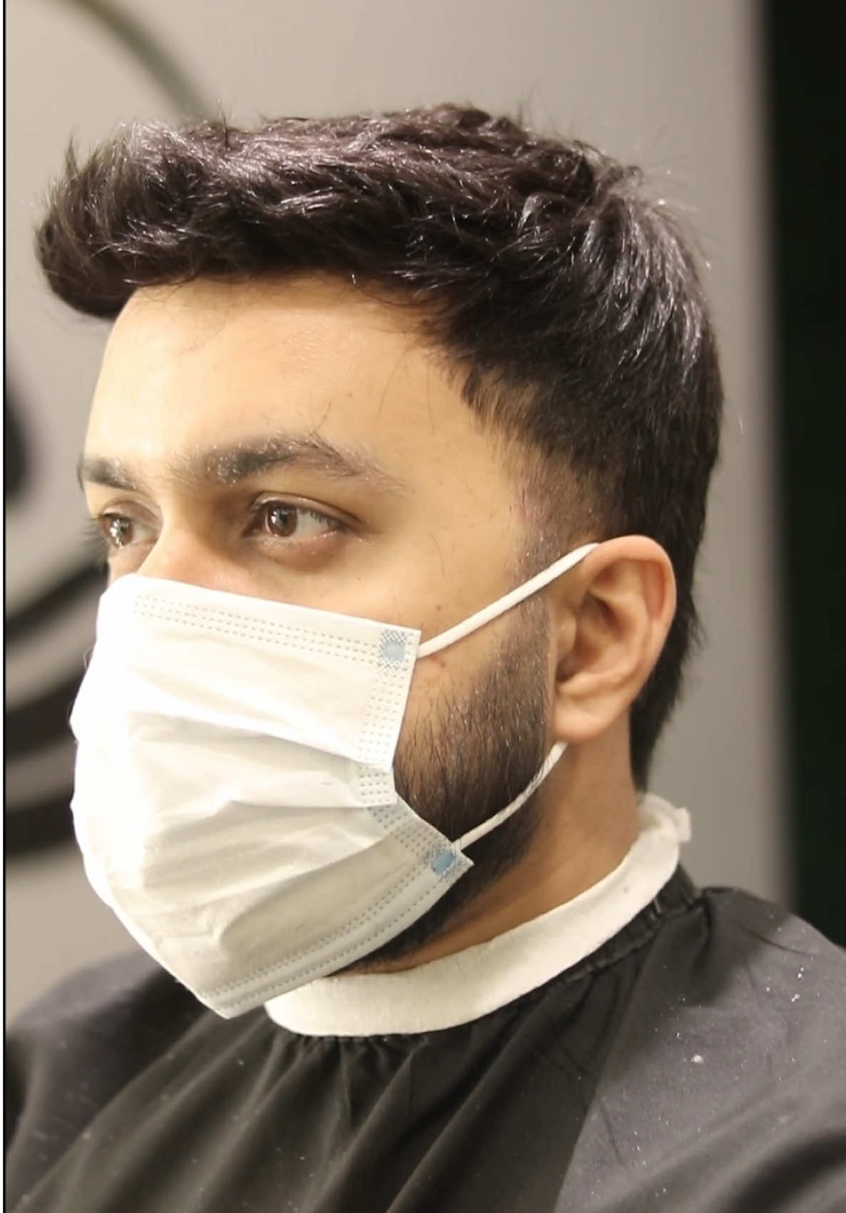 Hair Patch Transformation for men on islamabad and Lahore #hairpatch #hairpatchtransformstion #100kviews✔️tiktok #foryoupageofficiall #alopacia 