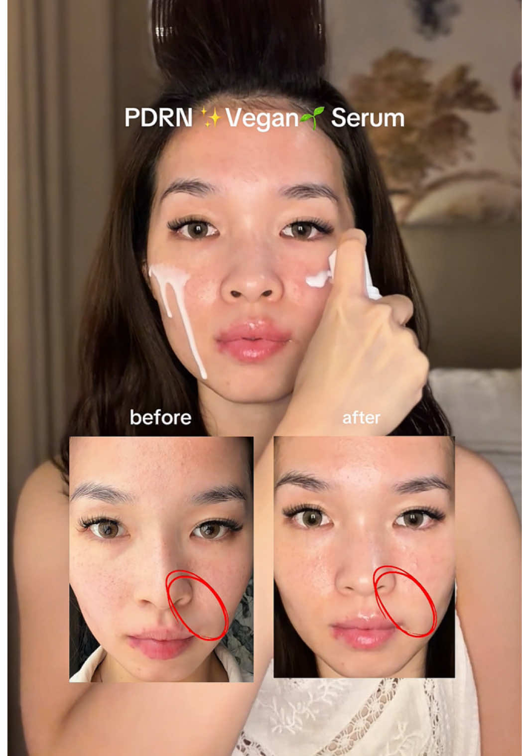 PDRN Vegan + Exosome + Hyalupeptide.. trio yang bikin kulit slow aging, fast glow✨😮‍💨💨 #somethinc #serum #PDRNvegan 