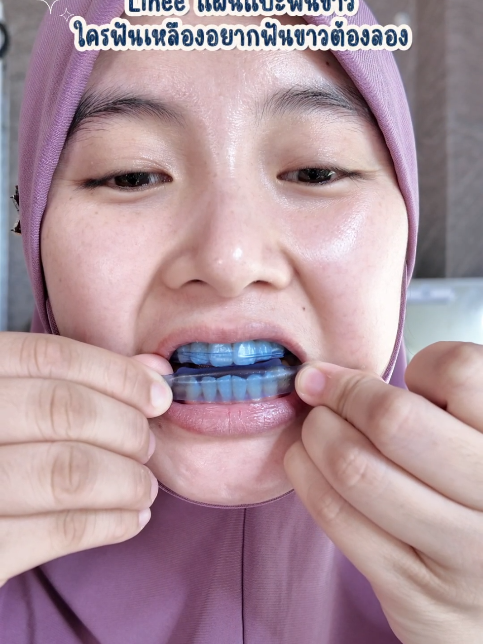 #lineeteeth  #ยาสีฟันaurawhitลินี  #ยาสีฟันไม่มีฟลูออไรด์ลินี  #ยาสีฟันลินี  #แผ่นแปะฟันขาวลินี 