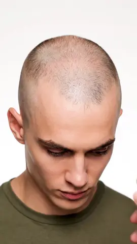 instent hair transformation 😬 #hair #growth #fyp #sora #satifying 